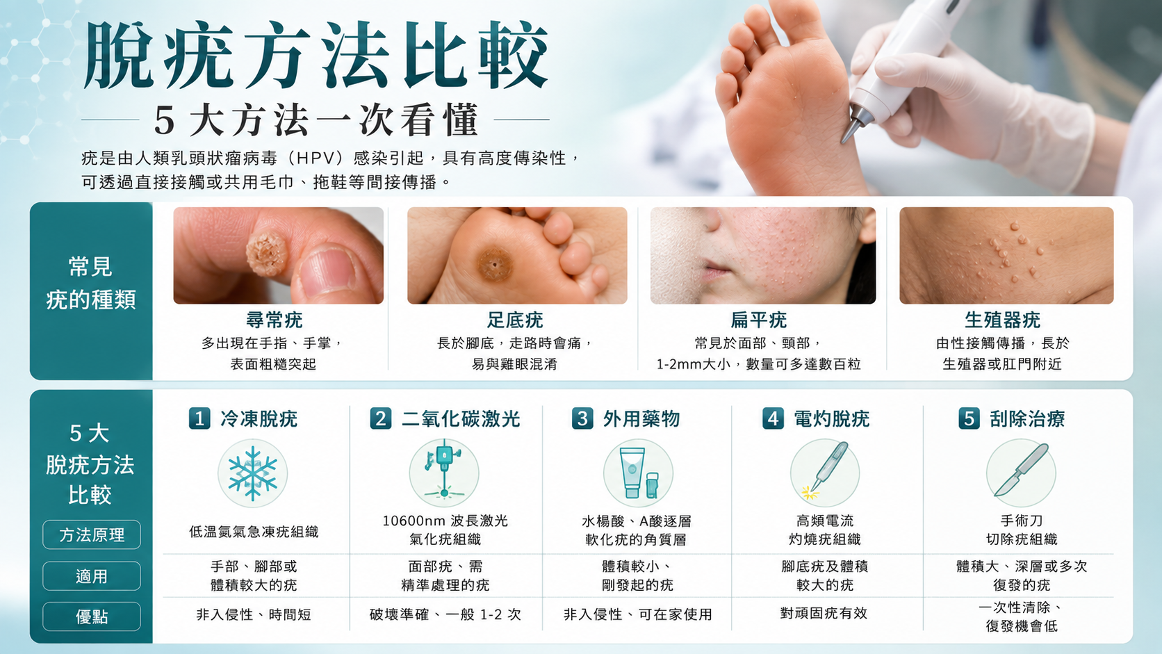 脫疣方法比較：冷凍、CO₂ 激光、電灼等 5 大方法一次看懂