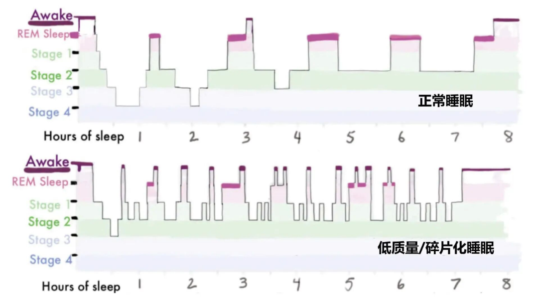 恢復力下降的日常信號