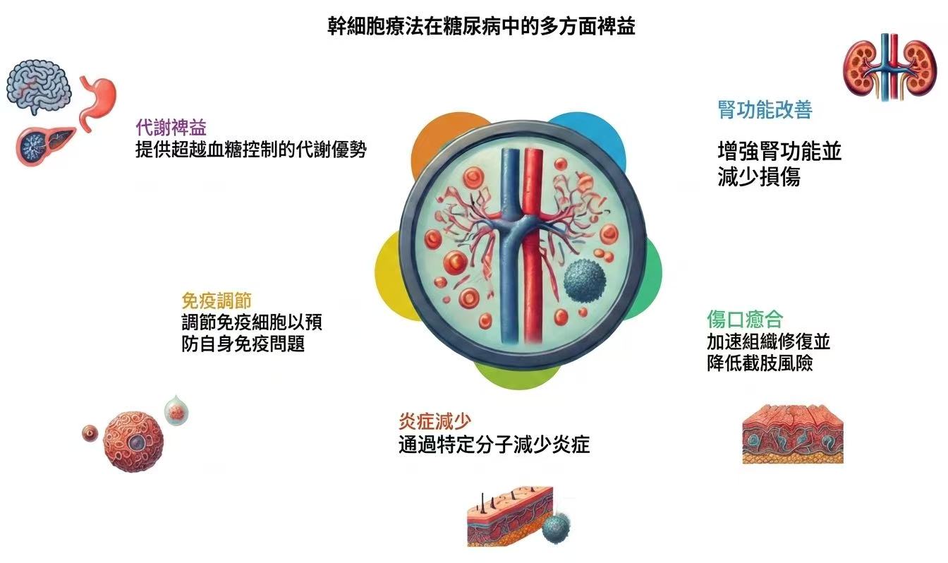 間充質幹細胞治療 2 型糖尿病的作用機制