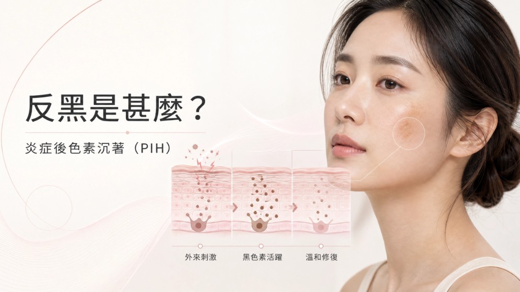 What is PIH? Post-inflammatory hyperpigmentation